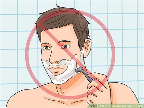 Therefore, you can use the following treatments to get rid of it without leaving a big ingrown hair scars. 3 Ways to Treat Infected Ingrown Hair - wikiHow