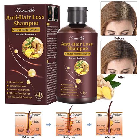 Hair Growth Shampoo Hair Loss Shampoo Anti Hair Loss Shampoo Helps