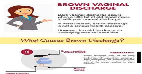Brown Vaginal Discharge Infographic