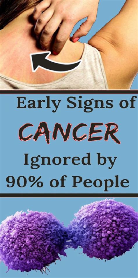 10 Signs Of Cancer That Women Shouldnt Ignore Health And Tips