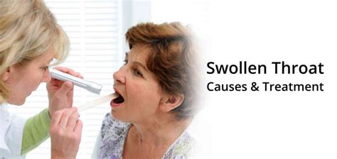 Swollen Throats Causes Prevention And Treatments