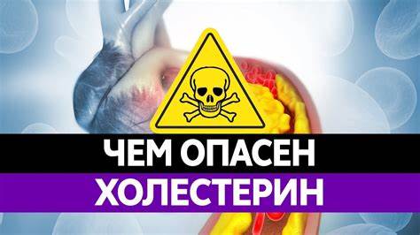 Повышенный холестерин диета рецепты ЧЕМ ОПАСЕН ПОВЫШЕННЫЙ ХОЛЕСТЕРИН В КРОВИ? Как он влияет на организм ЧЕМ ОПАСЕН ПОВЫШЕННЫЙ ХОЛЕСТЕРИН В КРОВИ? Как он влияет на организм Повышенный холестерин диета рецепты