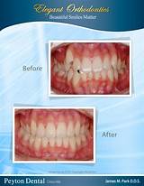 Park Dental Orthodontics Images