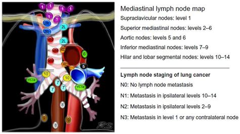 Thoracic Lymph Node Stations Radiology News Current Station In The Word
