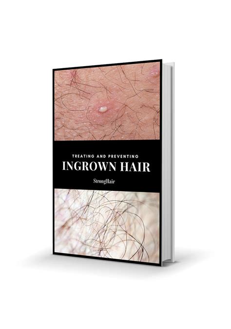 We attempt to treat and prevent them, fumbling through adolescence with diy google solutions that end in disaster. Treating and Preventing Ingrown Hair