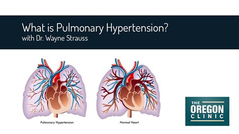 What Is Pulmonary Hypertension Youtube