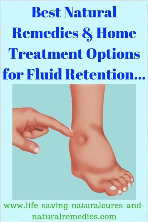 Top 7 Natural Remedies To Reduce Fluid Retention And Swollen Legs And