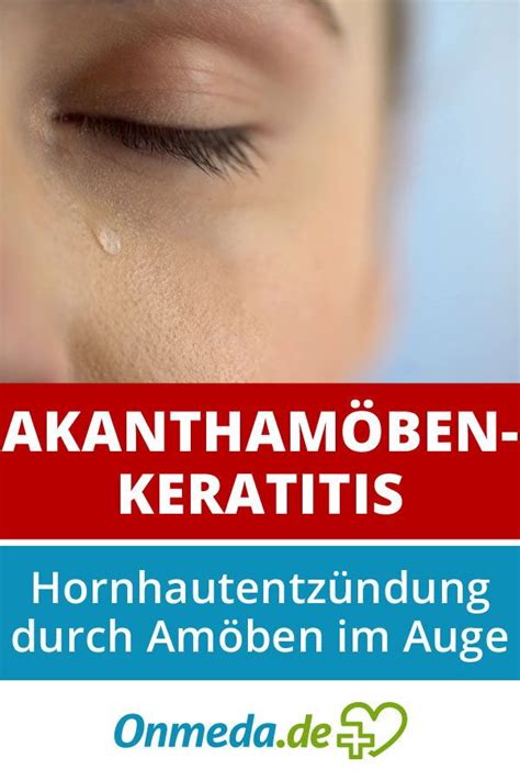 Lesen sie hier, welche arten von kontaktlinsen es gibt, welche vorteile sie bieten und was sie beim einsatz von kontaktlinsen beachten müssen. Kontaktlinsen: Erhöhtes Risiko für Hornhautentzündung ...