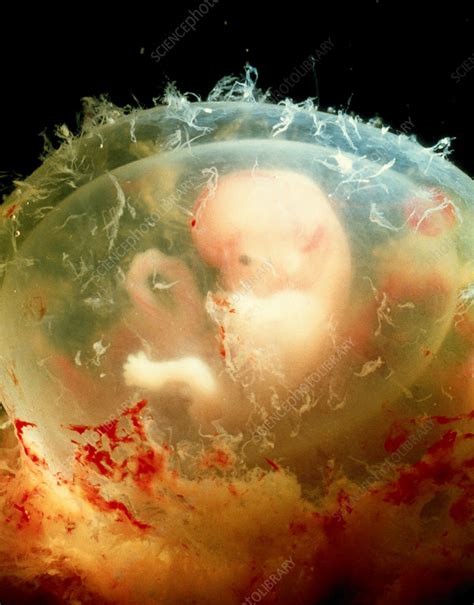 6 Week Embryo Stock Image P6800535 Science Photo Library