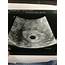 4 Week Ultrasound  BabyCenter