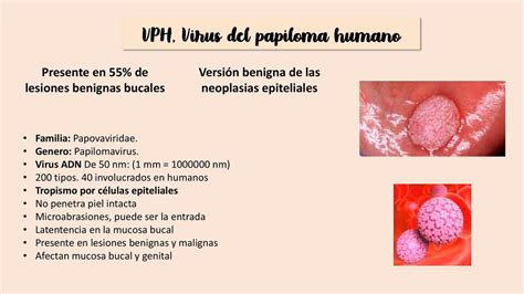 Rol Del Virus Del Papiloma Humano En El Desarrollo De Carcinoma Oral