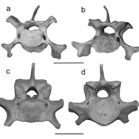 Cervical Vertebrae Of A Modern Moose In Anterior View Amnh122674