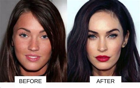 10 Famous Celebrities Who Have Had Plastic Surgery This Is Italy