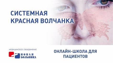 Диета системная красная волчанка Системная красная волчанка - YouTube Системная красная волчанка - YouTube Диета системная красная волчанка