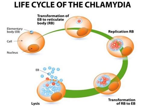 Home Remedies For Chlamydia Organic Facts