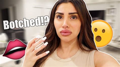 Watching the pennies and thinking you can save by diy lip fillers?beauty blogger ravebabe how this is a recipe for lip injections gone horribly wrong. Lip Fillers Gone Wrong... *he roasted me* - YouTube