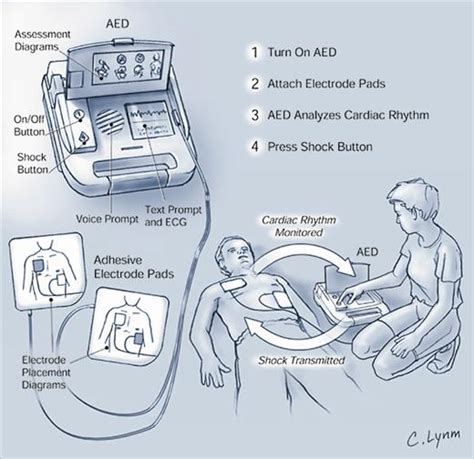 Improving Survival From Sudden Cardiac Arrest The Role Of The