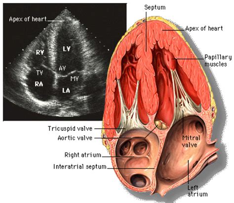 Making Sense Of An Echocardiogram Report For Gps Cardiology Institute