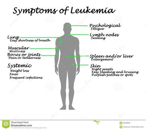 Symptoms Of Leukemia Vector Illustration 70924356