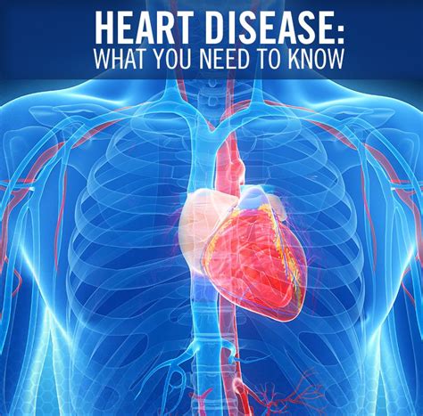 Heart Disease What You Need To Know Heart Disease Disease Senior