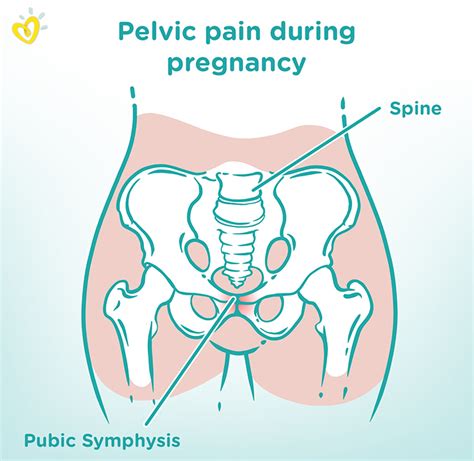 Pelvic Girdle Pain Pgp Spd —symptoms And Treatment Pampers