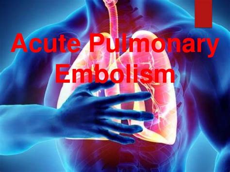 Acute Pulmonary Embolism Introduction Clinical Presentation Classi
