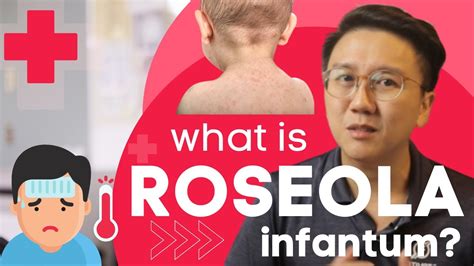 How To Identify Roseola Infantum Sixth Disease Symptoms
