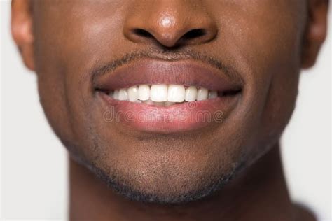 Close Up African Male Having Ultra White Toothy Smile Stock Image