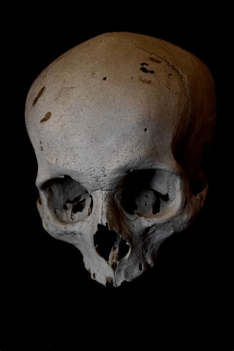 ☠krall☠ Skull Reference Skull Anatomy Real Human Skull