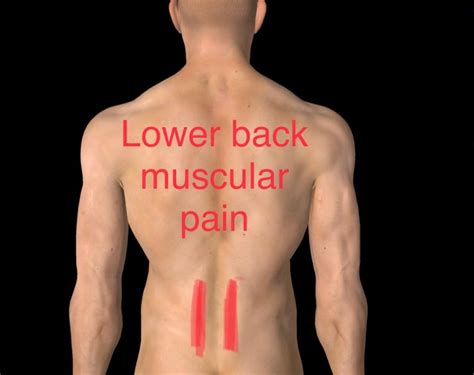 Back Pain Anatomy And Injury Information Body Works Physiotherapy