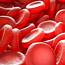 Anemia Symptoms And Signs Types Treatment Causes