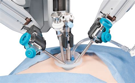 Single Incision Surgery Via New Robotic Systems The New York Times