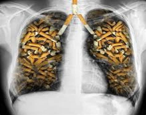 Daños Del Cigarrillo En Los Pulmones De Un Fumador