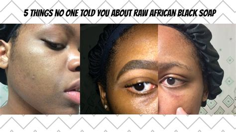 5 Things No One Told You About Raw African Black Soap