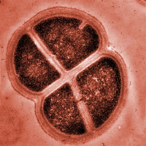 Conan The Bacterium Deinococcus Radiodurans A Listly List