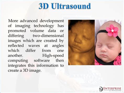 Ppt Diffrence Between 2d 3d 4d And Latest 5d Ultrasound Machine