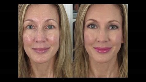 Under Eye Wrinkles Surgery Why Surgery Works For Under Eye Bags But