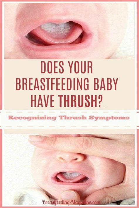 Pin On Breastfeeding Questions And Concerns