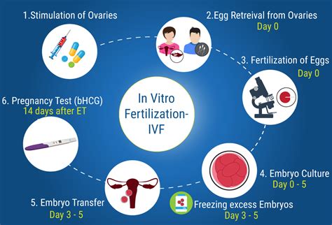 In Vitro Fertilization Ivf What Is Ivf When Is Ivf Recommended