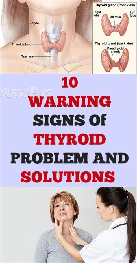 Ten Signs That Shows You Have Thyroid Problem And Solutions For It