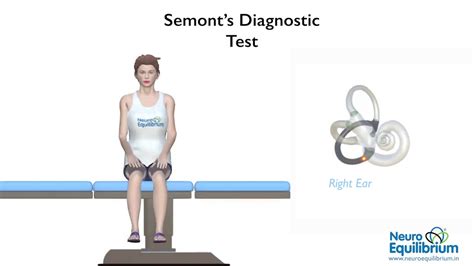 Semont Maneuver A Step By Step Guide To Treat Bppv Vertigo Youtube