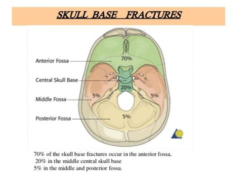 Basis Cranii Fracture Pdf