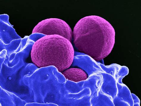 Methicillin Resistant Staphylococcus Aureus Mrsa Infection Az Dept