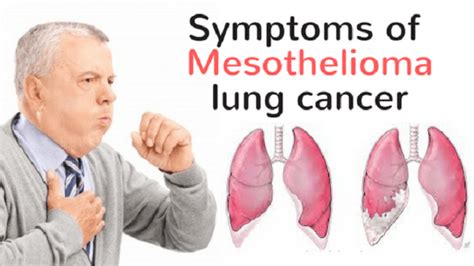 Symptoms Of Mesothelioma Lung Cancer Health All In One