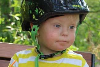 Learn more facts about down syndrome in this article. Down Syndrome and Vision | Impact Vision Therapy