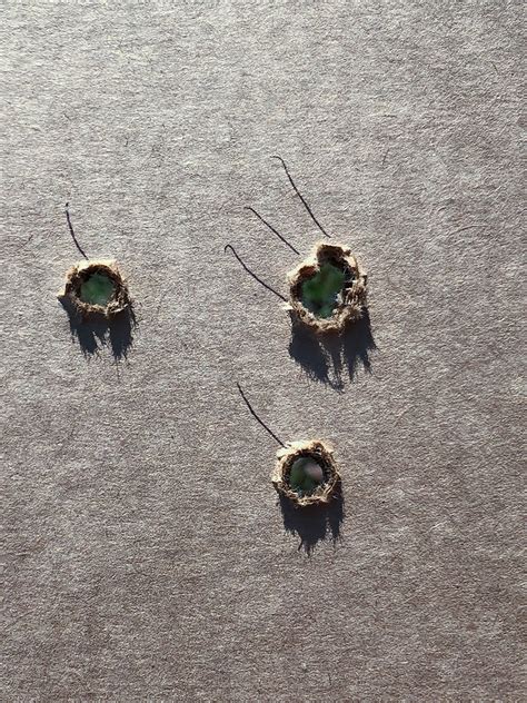 Skin lumps and bumps can pop up from time to time. FINDING LOST BULLET HOLES