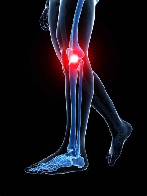 Contact ortho sport & spine physicians on messenger. Atlanta Knee Pain Treatment | Help for Chronic Knee Pain ...