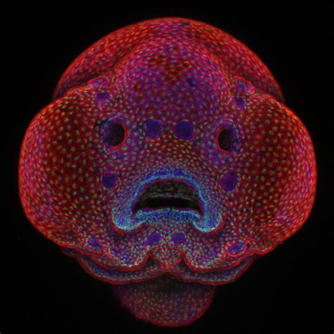 Nikon Small World 2016 Zebrafish Embryos Face Wins Microscope Photo