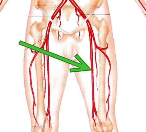 Femoral Artery Location