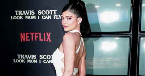 Kylie Jenner Praised For Showing Massive Leg Scar She Got At Five While Playing Hide And Seek